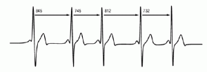 hrv